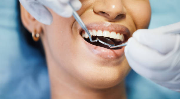 Best Emergency Broken Tooth Repair in Mont Clare, PA